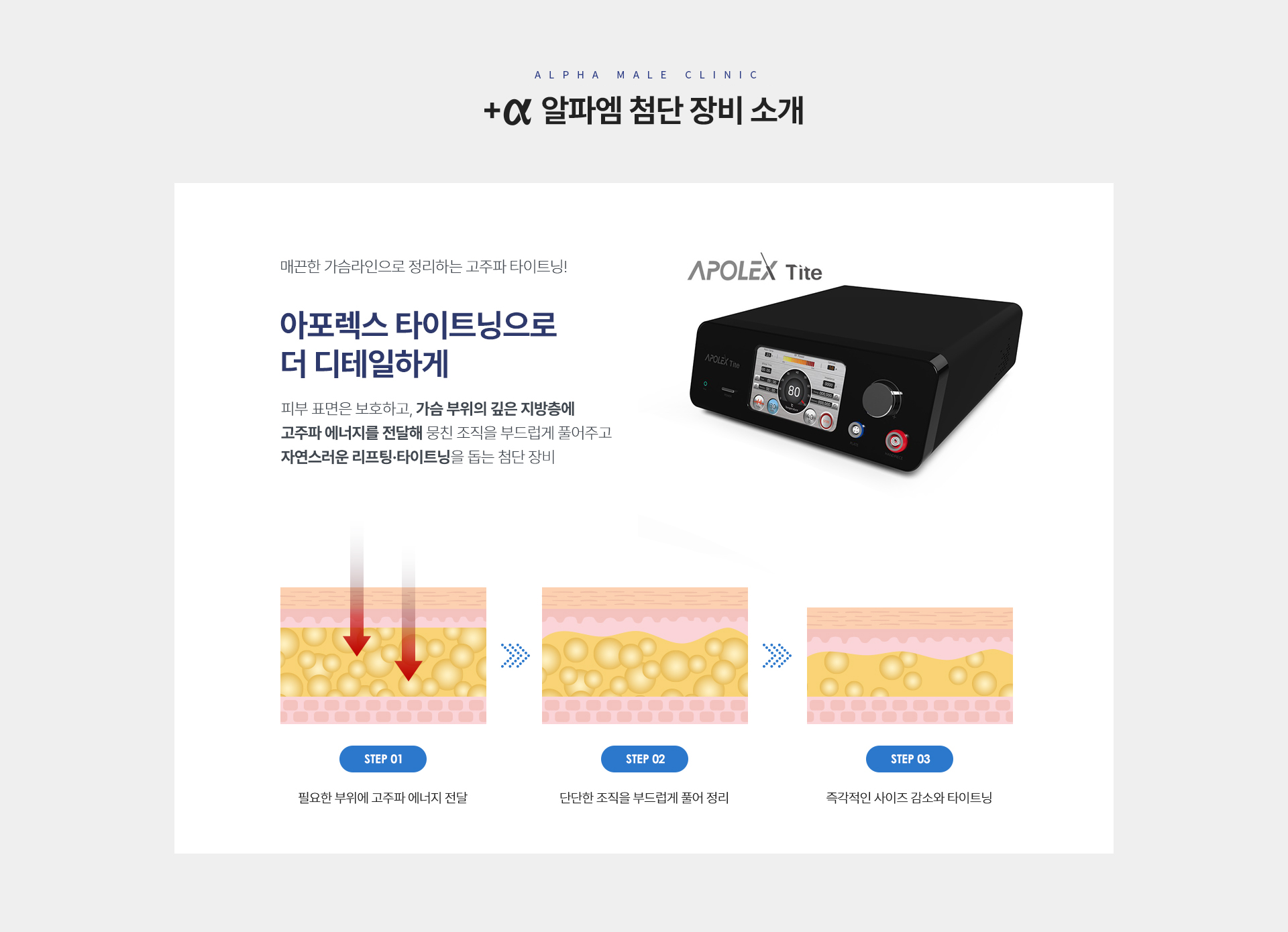여유증 수술 07