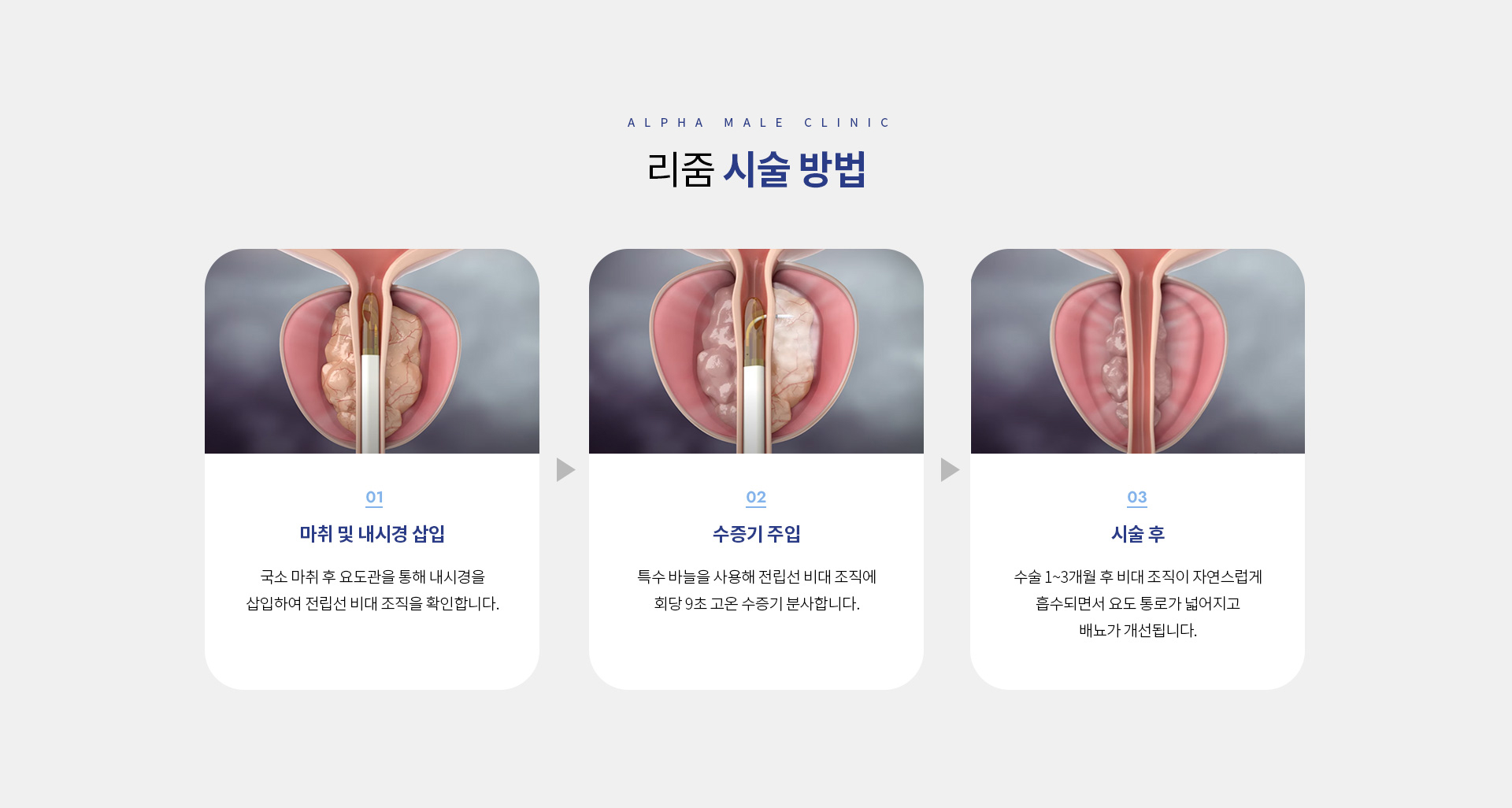 전립선비대증전립선염 08