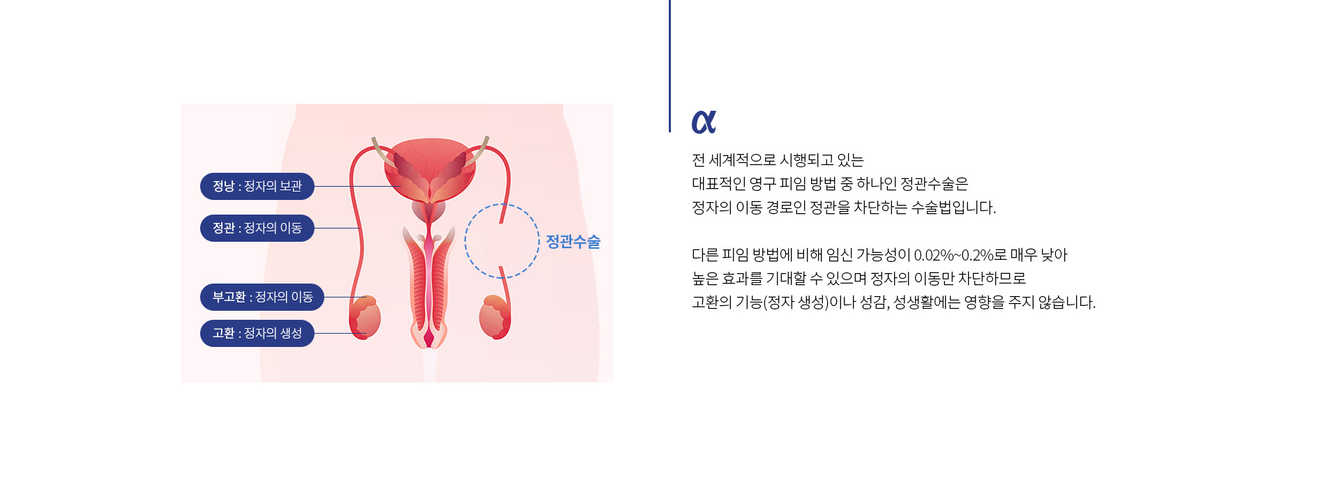 무도정관수술 02